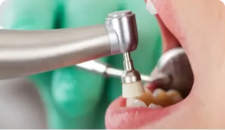 ¿Es realmente necesario las carrillas?